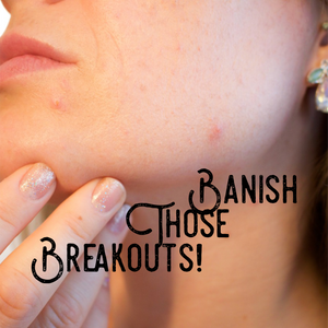 Banish those Break Outs!